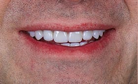 after dental treatment in Silver Spring, Maryland
