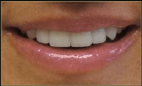 after dental treatment in Silver Spring, Maryland