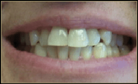 before dental treatment in Silver Spring, Maryland