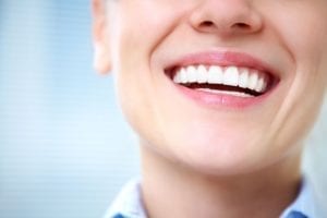 teeth whitening dentist sterling va