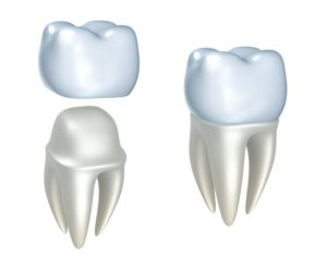 dental crown procedure Sterling Virginia