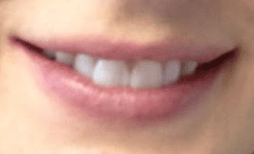 before dental treatment in Silver Spring, Maryland