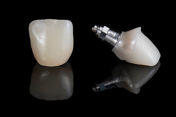 Implant Crowns: The Key To Restoring Missing Teeth