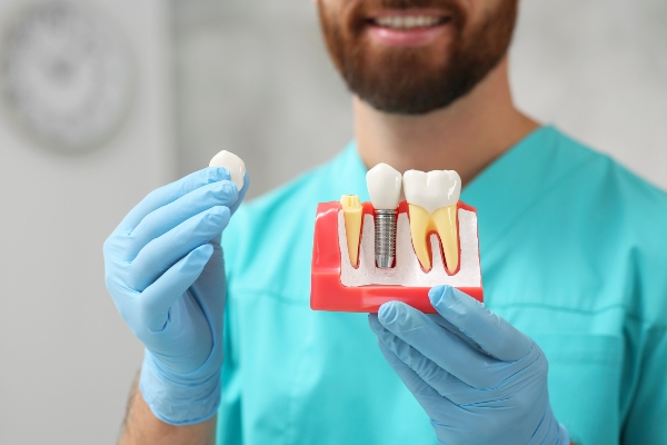 Services Offered By An Implant Dentist